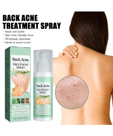 Back Acne Spray - 2% Salicylic Acid & Tea Tree Oil Treatment for Clear Skin | Effective Back & Body Acne Solution for Men & Women - Buy Online on GoSupps.com