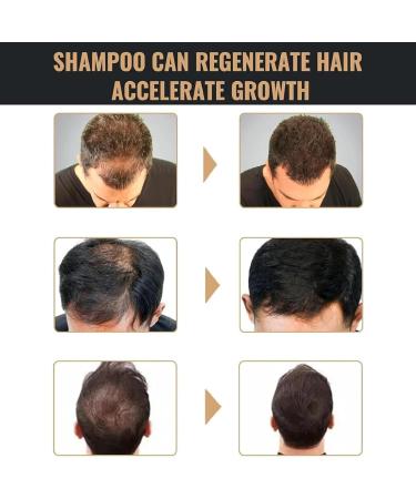 Root Activating Shampoo Shampoo Natural Hair Shampoos Long Lasting Nourishing Hair Care For Men And Women (1pc) - Buy Online on GoSupps.com