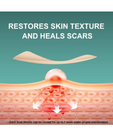 FUNNIR Silicone Scar Sheets Tape Strips - Heal Keloid & Surgery Scars - C-Section Tummy Tuck Treatment - 6 Pack - Buy Online on GoSupps.com