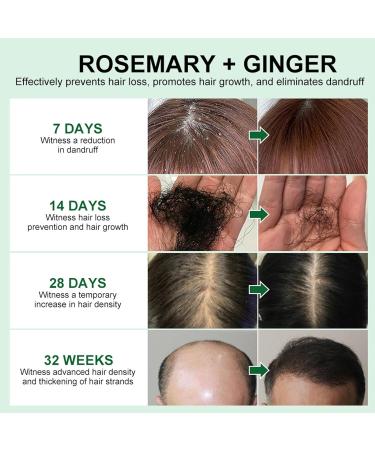 Rosemary Oil for Hair Hair Growth Oil Hair Rosemary Oil Relieve Dry Damaged Hair to Target Hair Loss Rosemary Hair Serum for Hair Rapid Growth and Thickening Trengthen Hair Roots - Buy Online on GoSupps.com