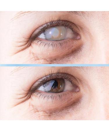 Moisturizing Eye Drops for Cataract & Glaucoma Relief | Antioxidant Dry Eye Solution (10 Pack) - Buy Online on GoSupps.com