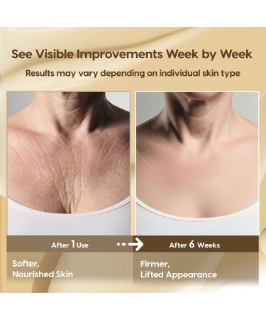 Crepey Skin Repair Treatment: Crepey Skin Repair Cream for Aging Skin with Pure Beef Tallow Soluble Collagen & Apple Fruit - Advanced Crepe Fix Cream for Neck Arms Chest Body - Unscented Body - Crepey Skin 4.26 Ounce (P  - Buy Online on GoSupps.com