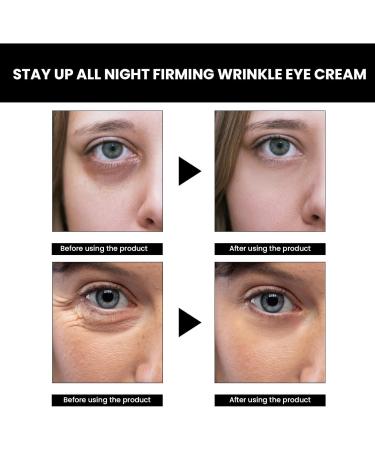 GNAUMORE Celyn eye cream retinol eye cream eye cream against wrinkles and dark circles eye cream against wrinkles anti-ageing eye cream for eye firming cream eye cream against wrinkles for men and women  - Buy Online on GoSupps.com