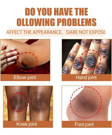 GFOUK Virgin Papaya Seed Oil Pure Natural Virgin Papaya Seed Oil Fights Blemishes Large Pores Relieve Itchy Scaly Irritated Eczema and Psoriasis (1PC) - Buy Online on GoSupps.com