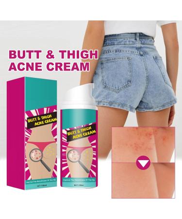  Eazerom 14 Cream for Pimple Removal on Glutees 100ml Ass Acne Cream Glutees Pimple Reduction Removes Pimple and Redness for Glutei and Coscebutt - Buy Online on GoSupps.com