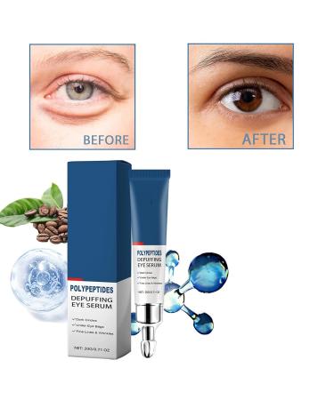 Hydrating Eye Cream & Serum for Dark Circles | Caffeine Under Eye Treatment for Firmness & Puffiness - Buy Online on GoSupps.com