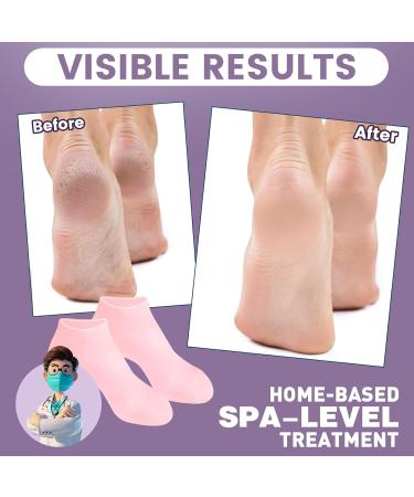 Buy 5 Pairs Silicone Socks for Cracked Feet | Moisturizing Foot Care | Fits Size S/M | Assorted Colors - Buy Online on GoSupps.com