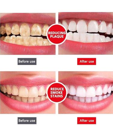 3 Days Whitening Japan Technology Whitening Aroma Toothpaste Sp-Y6 Probiotic Whitening Oral Paste Sp-Y6 Probiotic Whitening Toothpaste Natural Stain Removing Probiotic Toothpaste - Buy Online on GoSupps.com