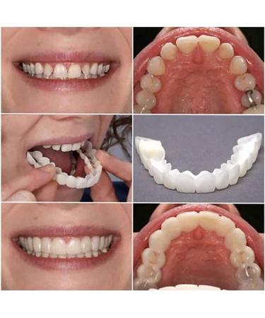 Giural Cosmetic Tooth Instant Veneers | Snap-On Teeth & Simulation Braces for a Beautiful Smile - Reusable & Removable (2 Pairs) - Buy Online on GoSupps.com