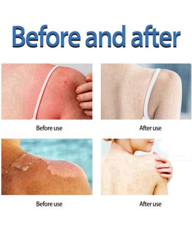Centella Sunscreen SPF 50 PA++++ Face & Body Water-Fit Sun Serum Centella Calming Moisture Daily Sunscreen Korean Sunscreen with No White Cast Refreshing No Sticky Sun Cream UV Defense Suncream - Buy Online on GoSupps.com