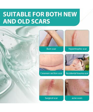 TULAMORIY 20 g scar cream soothes scar ointment highquality scar ointment cream for the care of scars gentle scar cream improves the appearance of the skin cares for fresh and old - Buy Online on GoSupps.com