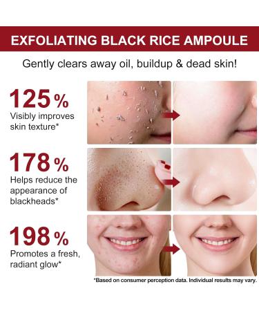 Black Rice Exfoliant+Rice Ampoule Exfoliant Exfoliating Face Scrub & Body Scrub Dead Skin Cells Blackheads Remover For All Skin Types Korean Skin Care 100ml - Buy Online on GoSupps.com