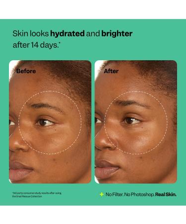 Peach Slices - Snail Rescue All-in-One Deep Moisture Cream (2.82 oz) - Snail Mucin - Intensive Hydration Soft Skin - Squalane Hyaluronic Acid & Cica - Vegan Cruelty Free Korean Skin Care & Beauty - Buy Online on GoSupps.com