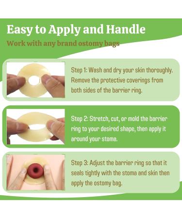 Elastic Moldable Ostomy Barrier Rings 2 (48mm) 4mm Thickness - Non-Leaking Seal, Sting-Free Hydrocolloid Skin Barrier Extender Ring for Colostomy Bags - 10 Pack - Buy Online on GoSupps.com