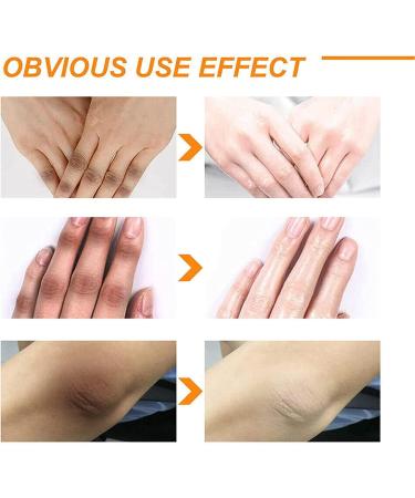 100 ml de cr me blanchissante pour le corps Lotion gommante peau d'orange cr me gommante dissolvant de taches fonc es Gel de gommage blanchissant imm diat pour peau fonc e cou aisselles genoux - Buy Online on GoSupps.com