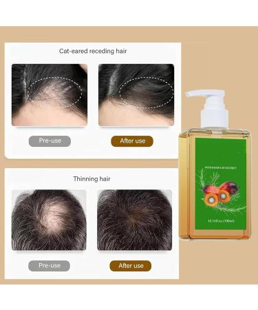 Nourishing Rosemary Shampoo shampoo that nourishes and regenerates hair soft and voluminous suitable for both men and women leaving hair healthier - Buy Online on GoSupps.com