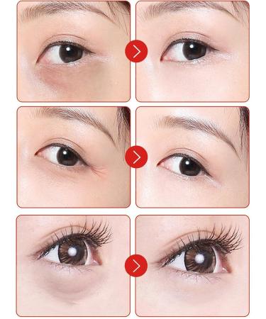 Pomegranate Eye Cream Anti Aging - Eye Cream for Dark Circles and Puffy Eyes - Moisturize Hydrate Eye Contour Area Lock Water - Firm Lift Reduce Dullness Fade Fine Line Smooth Skin Restore Elasticity - Buy Online on GoSupps.com