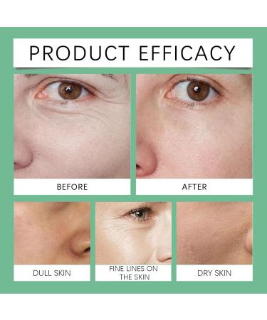 Q10 Day Cream for Face - Face Cream for Anti Aging - Anti Wrinkle Face Cream with Retinol and Collagen - Hydrating Face Cream for Dry Skin - Moisturiser Face Women - Firming Smoothing Moisturising - Buy Online on GoSupps.com