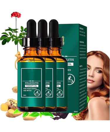 Natural Scalp Therapy Hair Oil Scalp Folliculitis Relief Therapy Nourishing Scalp Oil Balancing Oils Protect Scalp Health