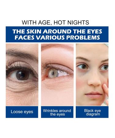 Jasmine Ointment for Dark Circles | Eye Cream with Collagen & Aloe | International Shipping - Buy Online on GoSupps.com