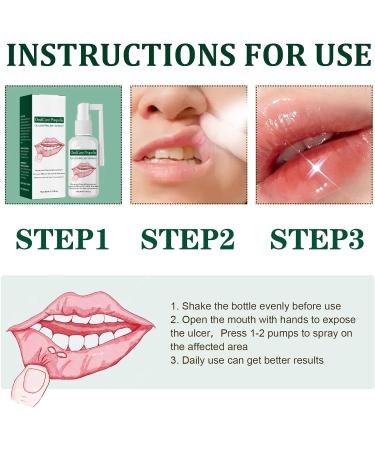 Mouth Ulcer Treatment Spray 30ml Mouth Ulcer Spray OralCare Propolis Ulcer Relief Spray for Wound Protection & Relief Canker Sore Treatment Herbal Mouth Spray Breath Spray for Bad Breath (2Pcs) - Buy Online on GoSupps.com