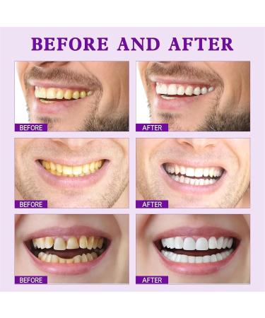 EXQST Toothpaste SP-7 Probiotic Whitening Toothpaste Fresh Breath Whitening Toothpaste Teeth Stain Removal Toothpaste Complete Dental Care - Buy Online on GoSupps.com