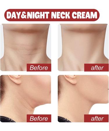 Neck Tightening Cream - Neck Firming Cream with Retinol and Collagen - Rich in Hyaluronic Acid Neck Cream Tightening Lifting Sagging Skin - Women's Anti Wrinkle Moisturizer Neck - Buy Online on GoSupps.com