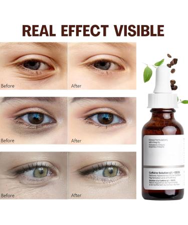 Caffeine Solution 5%+EGCG Eye Serum Caffeine Eye Serum Caffeine Eye Cream Anti Aging Under Eye Cream for Dark Circles and Puffy Eyes Instant Wrinkle Removerl Fade Fine Line Eye Bag Removal-30ml - Buy Online on GoSupps.com