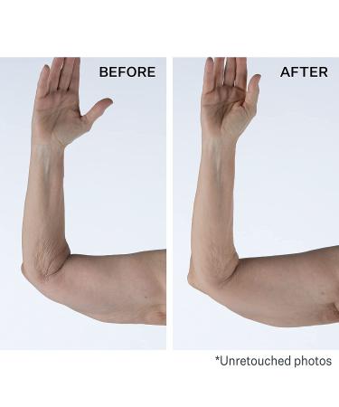 StriVectin Tighten & Lift Crepe Control Body Cream - Firmer, Brighter Arms & Legs - Buy Online on GoSupps.com