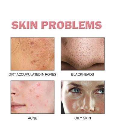 5-in-1 Cleansing Mousse - Deep Clean Hydrate Nourish Control Oil & Fade Acne Scars Gentle Facial Wash For All Skin Types Bullet Points(3PCS) - Buy Online on GoSupps.com