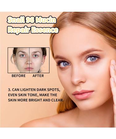 KOAHDE Hydrating Snail Face Serum Brightening Snail Mucin Essence Natural Niacinamide Snail Face Serum Snail Skin Care Face Serum Snail Anti Wrinkle Face Serum Lightweight Face Serum 100ML - Buy Online on GoSupps.com