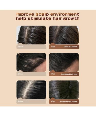 Hocossy Castor Oil Hair Growth Shampoo - Volumizing Shampoo for Hair Loss Thin Hair Shampoo for Men & Women Natural Ingredients 350m Castor Oil Shampoo - Buy Online on GoSupps.com