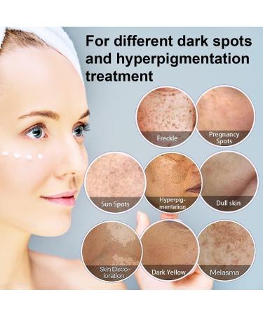 Dark Spot Remover for Face - 3PCS Dark Spot Corrector Cream for All Skin Tones - Melasma, Freckle, Sun Spot Remover & Blemish Reducer 2.1 FL OZ - Buy Online on GoSupps.com