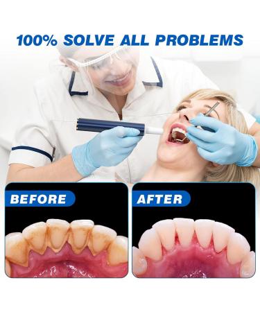 HassoKon Teeth Cleaning Kit with 4 Modes & 4 Heads (Blue) - Ultimate Dental Care Solution - Buy Online on GoSupps.com