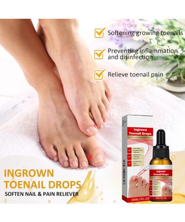 30ml Ingrown Toenail Treatment Drop Natural Ingrown Toenail Correction Oil Cuticle Care Oils for Toe Fungal Nail Treatment Trimming Nail Softening Drop Extra Strong for Damaged Nails - Buy Online on GoSupps.com