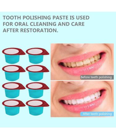 Professional Tooth Polishing Paste - 40 Pieces | Effective Tartar Removal & Dental Care Cream - Buy Online on GoSupps.com
