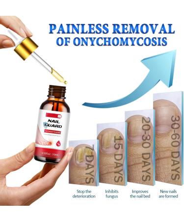 Nail Fungus Treatment for Toenail - 7 Day Fungal Nail Treatment for Toenails Extra Strong - Fungal Nail Treatment - Toenail Fungus Treatment for Thickening Yellow-Brown Discoloration Ragginess 10ML - Buy Online on GoSupps.com