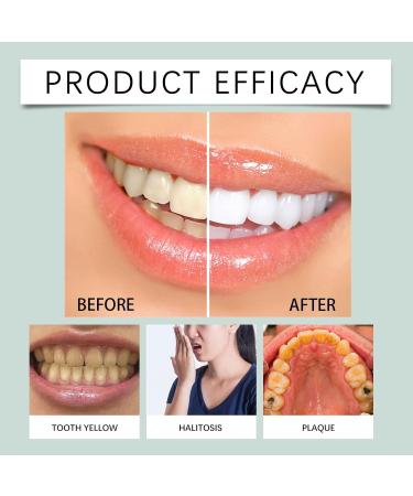 Mint Toothpaste - Daily Gentle Cleaning Stain Removal Teeth Protection Bad Breath Fight Gradually Brightens & Maintains Oral Hygiene(3PCS) - Buy Online on GoSupps.com