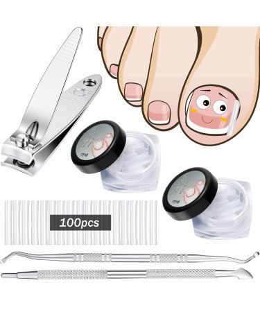 103 Pack Ingrown Toenail Correction Kit 100 Pieces Ingrown Toenail Corrector Strips 2 Pieces Ingrown Toenail File and Lifter and Nail Clippers for Men Women Foot Care