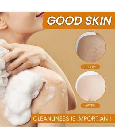  Beslibate Turmeric soap turmeric skin lightening soap turmeric skin lightening soap dark spot removal for face and body moisturizing lightening bath soap 100g 2PC soap-4 - Buy Online on GoSupps.com