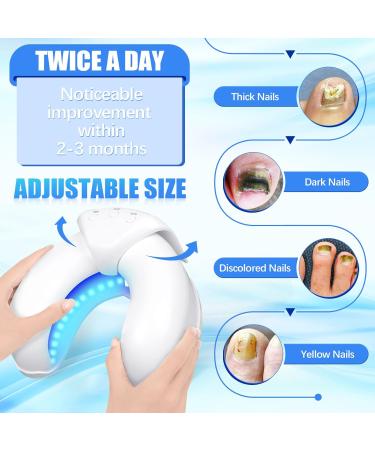 Anti Fungal Nail Treatment Device Anti Fungal Laser for Toenail Finger Toe Nail Fungus Remover Laser-Device Toenail Fungus Treatment 7-Minute Home Treatment. - Buy Online on GoSupps.com
