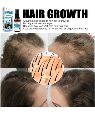 30ml Hair Growth for Women | Hair Thickening Spray for Thin Hair - Keeps Hair Regrowth for Men and Women Hair for Men Women Thinning Repair Care - Buy Online on GoSupps.com