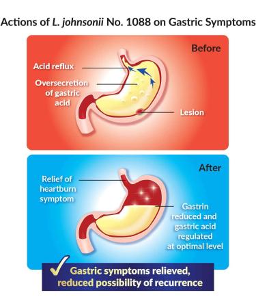GASTRICELL: Natural Defense Against Gastric Distress - 30 Sachets | Eliminate H. Pylori, Relieve Acid Reflux & Heartburn, Regulate Gastric Acid - Root Cause Solution - Buy Online on GoSupps.com