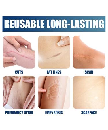Scar Gel Cream for Surgical Scars C-Section Stretch Marks Acne Burns & Keloids - Effective Treatment for Old & New Scars - Buy Online on GoSupps.com