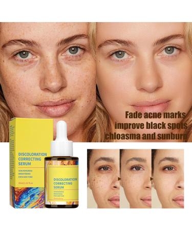 Dark Spot Correcting Glow Serum - Dark Spot Remover for Face - Nicotinamide Serum for Fade Acne Marks - Face Serum to Even Skin Tone & Shrink Pores - Face Moisturiser Skin Care for All Skin Types - Buy Online on GoSupps.com
