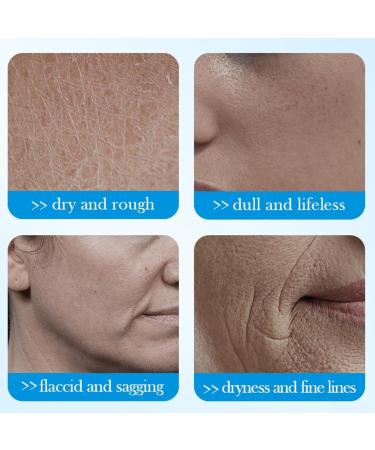 Hyaluronic Acid Anti-Wrinkle Cream Hyaluronic Acid Moisturiser Face Women & Men Anti Aging Face Cream Face Moisturiser For Mature & Young Skin Hydrate Smooth Dry Skin - Buy Online on GoSupps.com