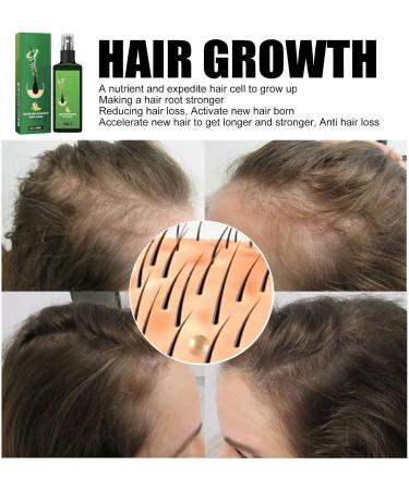 13 ginger hair growth serum hair density nourishment spray with ginger anti hair loss nourishing ginger spray for all hair types hair serum treatment - Buy Online on GoSupps.com