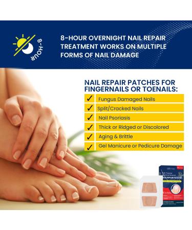 Extra Strength Multi-Purpose Fungus Nail Patches | Effective Toenail & Ingrown Toenail Treatment | Nighttime Fungal Nail Solution - Buy Online on GoSupps.com