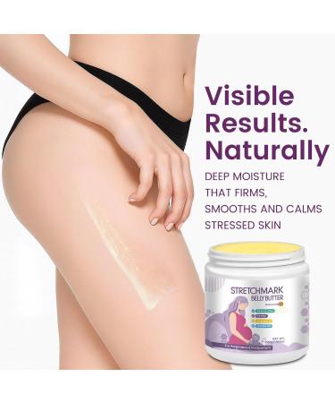 AOAO Stretch Mark Butter for Pregnancy | Body Balm for Women with Shea Butter & Vitamin E | Paraben-Free Formula for Scars & Stretch Mark Repair | Belly Butter for Pregnant Women (Shea Butter_1) - Buy Online on GoSupps.com
