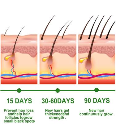 Organic Rosemary Castor Hair Oil & Scalp Strengthening Hair Growth Oil with Coconut Oil and Olive Oil - Nourishing Treatment for Dry Damaged Hair Split Ends and Healthy Growth (3pc) - Buy Online on GoSupps.com